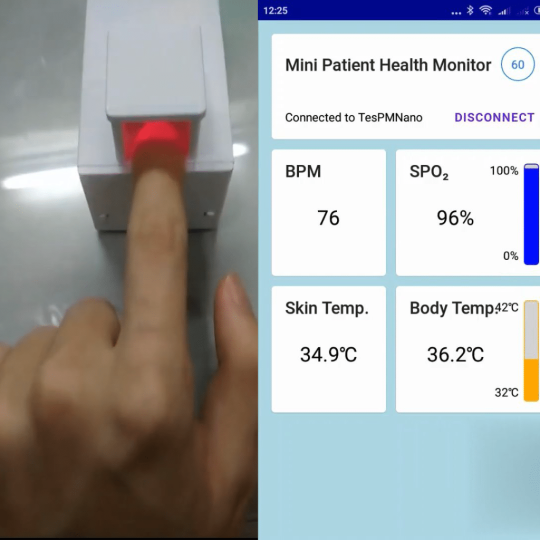 Cukup Satu Sensor dalam HOPE Patient Monitoring